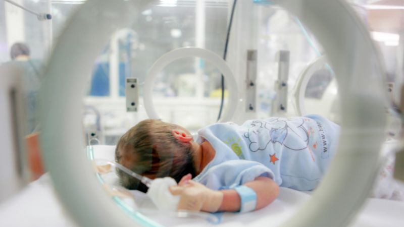 Artificial Intelligence can be trained to detect lung disease in premature babies - preview image