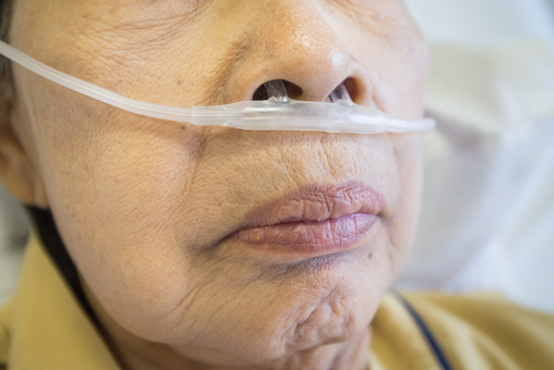 Moving away from therapeutic nihilism in COPD - preview image