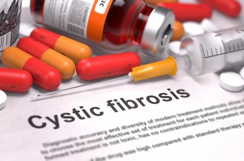 New research finds promising way forward for CF treatment - preview image
