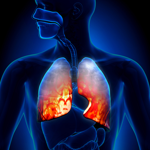 The Stop TB Partnership warns of insufficient funding to tackle tuberculosis - preview image
