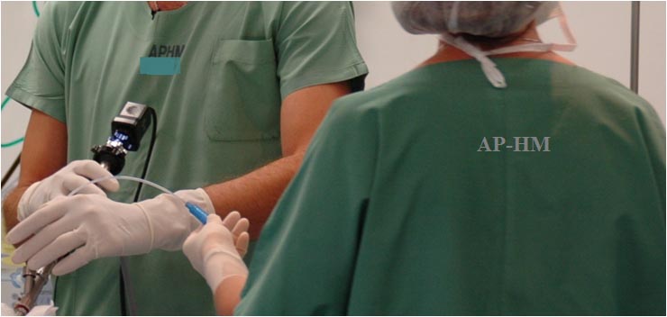 Skills Course: Rigid bronchoscopy - preview image