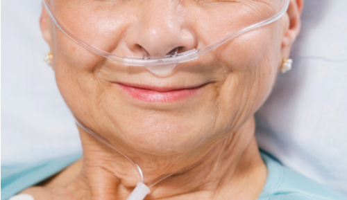 The semantics of COPD exacerbations - preview image