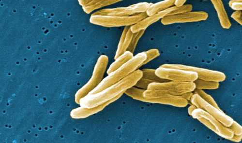 ERS supports call on G20 leaders to prioritise TB in upcoming AMR talks - preview image