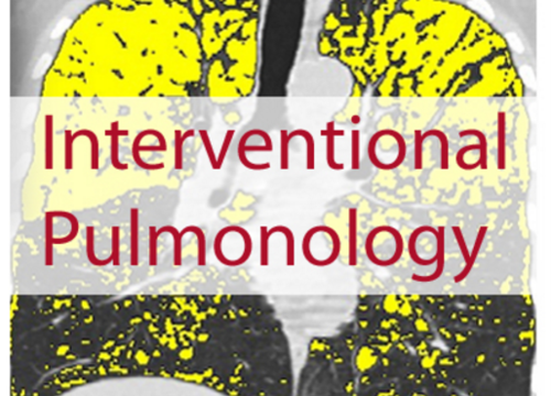 New CME Online module: Choosing the right interventional pulmonary technique for your patient - preview image